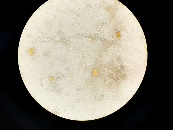 How to Recognize and Treat Mites in Pet Rats?